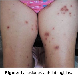 figura 1