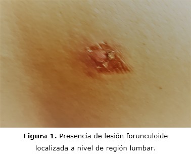 figura 1