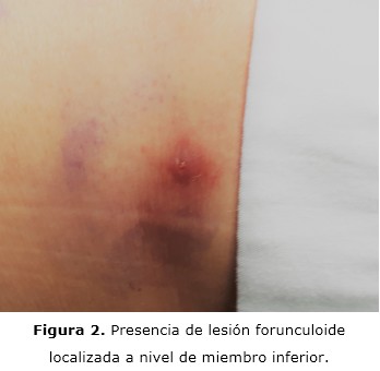figura 2