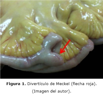 Figura 1