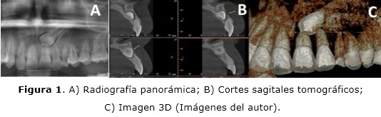 Figura 1