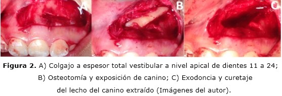 Figura 2