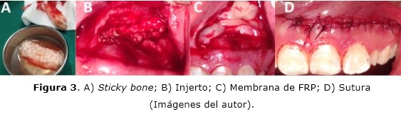 Figura 3