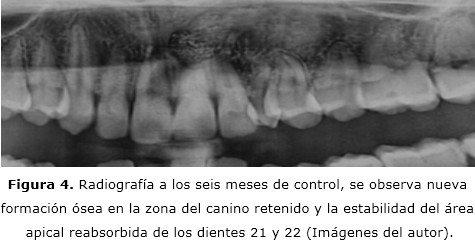Figura 4