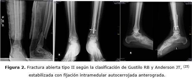 figura 2