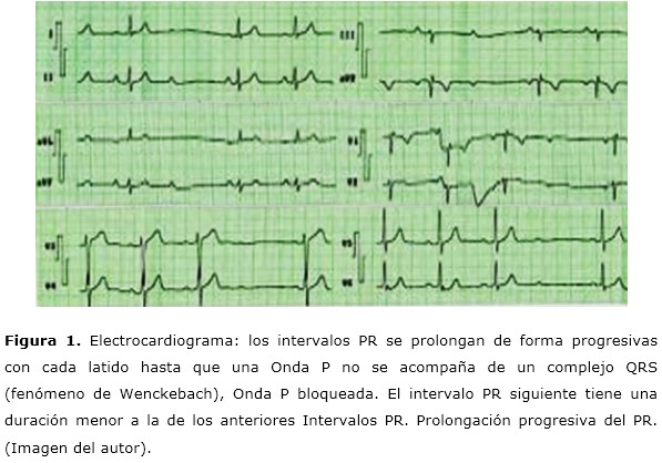 Figura 1