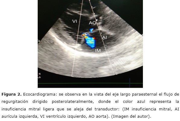 Figura 2