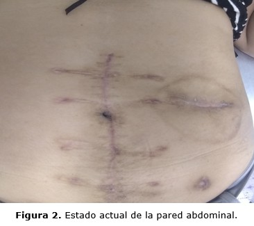 figura 2
