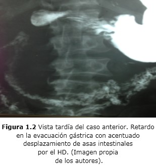 Figura 1.2
