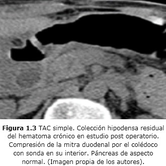 Figura 1.3