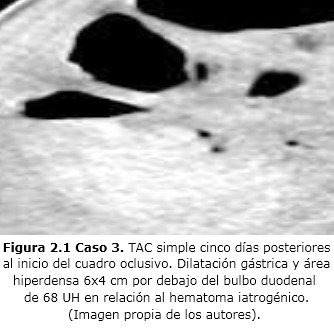 Figura 2.1