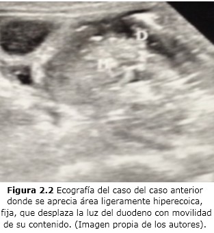 Figura 2.2