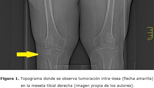 Figura 1