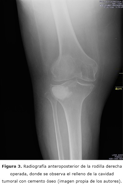 Figura 3