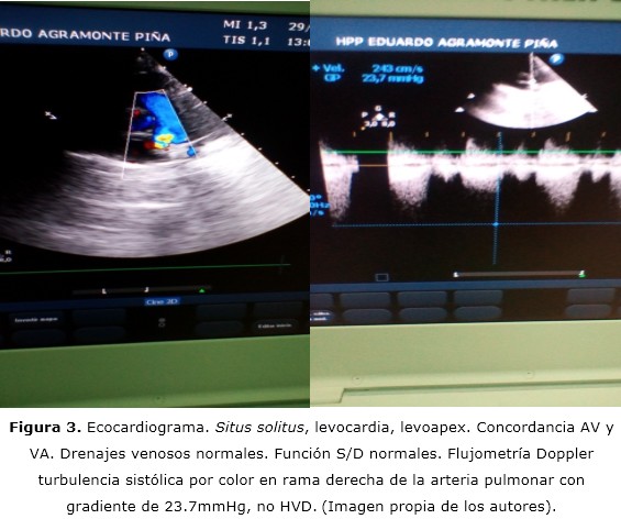 Figura 3