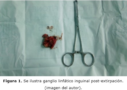 Figura 1