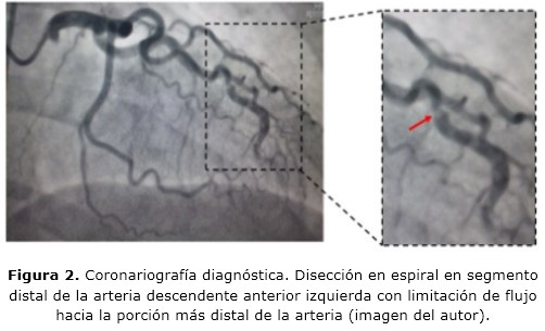 Figura 2
