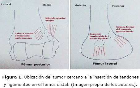 Figura 1