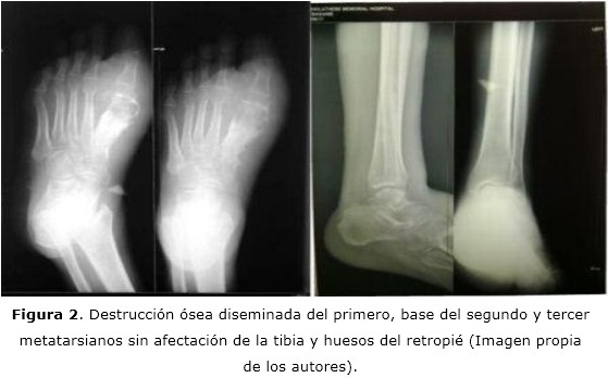 figura 2