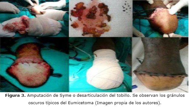 figura 3