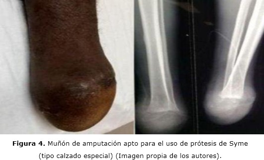 figura 4