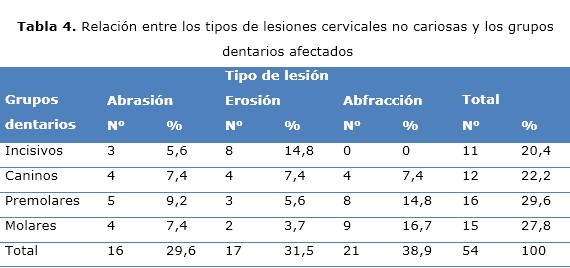 tabla 4
