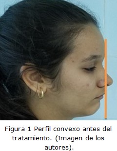Figura 1