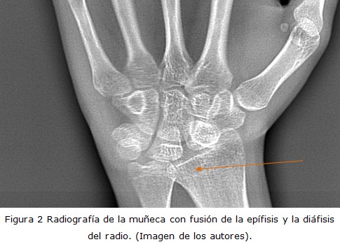 Figura 2