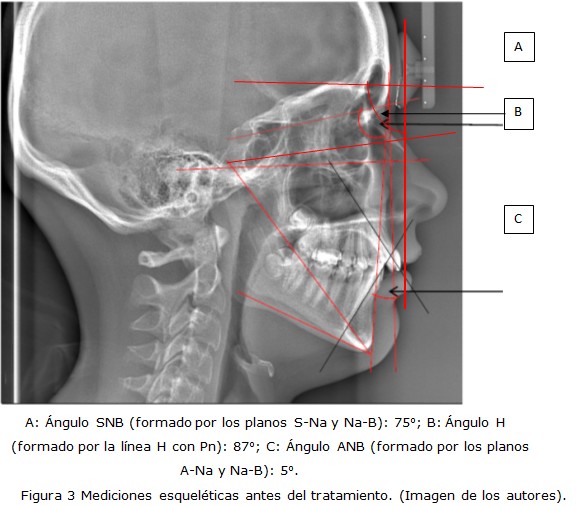 Figura 3