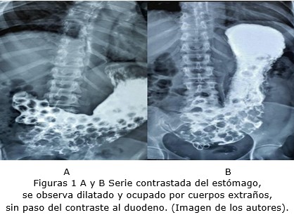 Figura 1 A