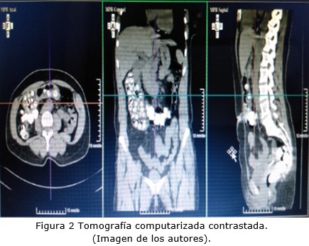 Figura 2