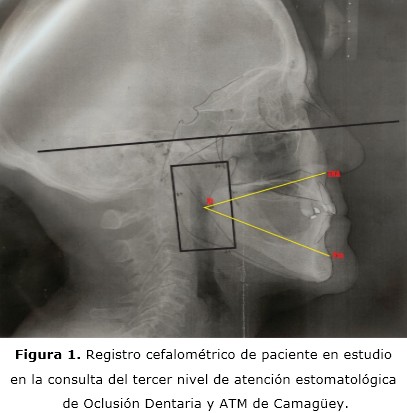 figura 1