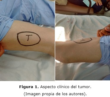 Figura 1