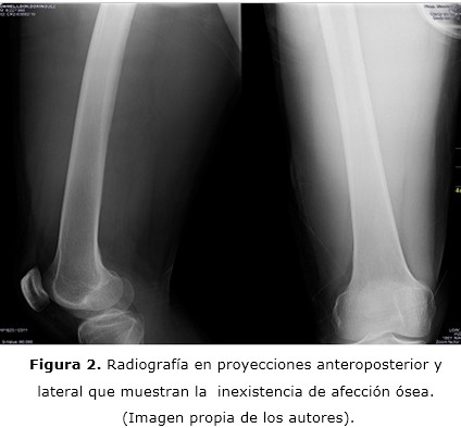 Figura 2