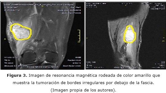 Figura 3