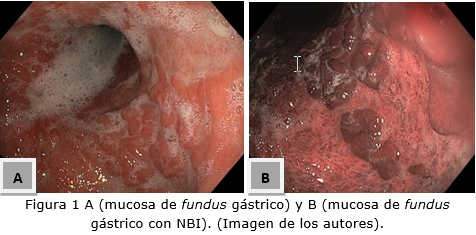 Figura 1 A y B