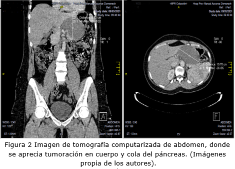 figura 2