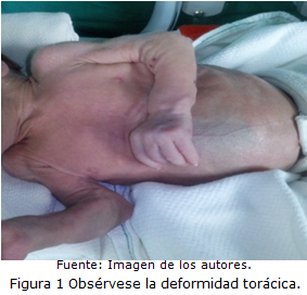 figura1