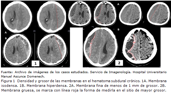 figura 1