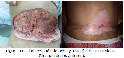 figura3