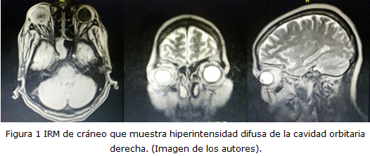 figura 1