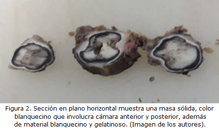 figura2