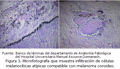 figura3