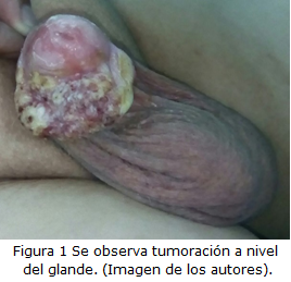 figura 1
