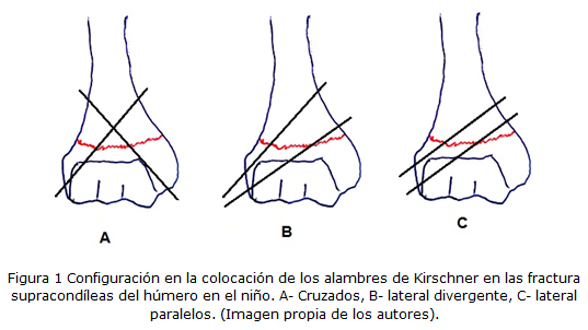 Figura 1