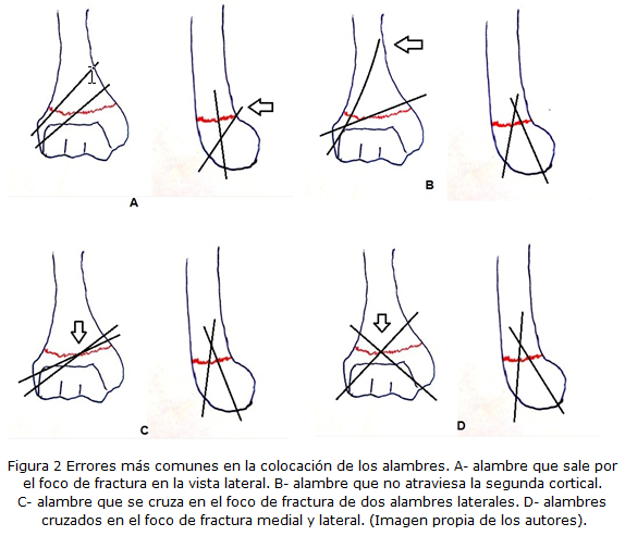 Figura 2
