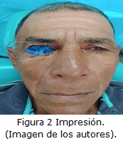 figura2