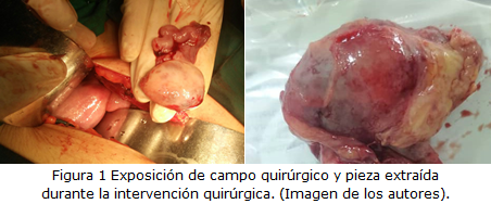 figura1