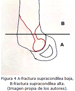 figura4
