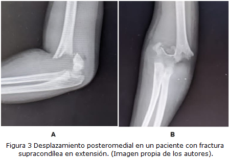 figura3